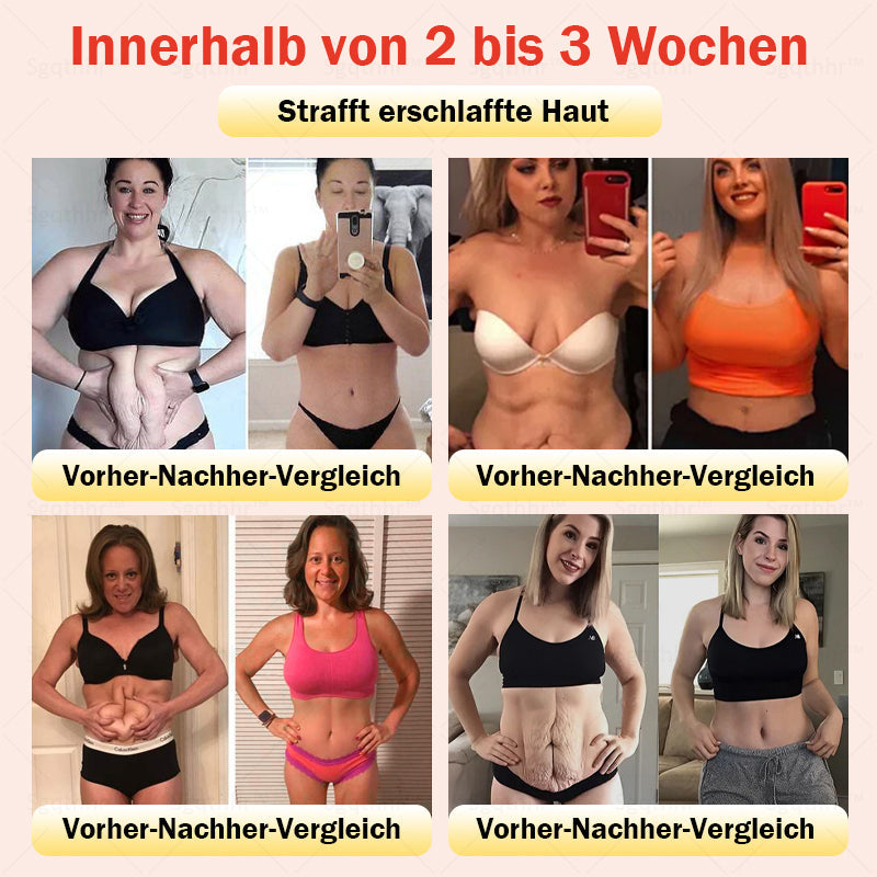 𝐒𝐠𝐪𝐭𝐡𝐡𝐫® 👩⚕️ Sculpting-Hose aus Tourmalin-Titan - 💎 Perfekte Silhouette, Frauen-Gesundheitspflege 🔥 Letzter Tag 🔥 70 % Rabatt