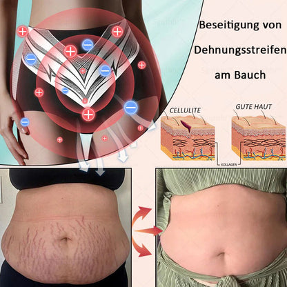𝐒𝐠𝐪𝐭𝐡𝐡𝐫™ 👩‍⚕️ Sculpting-Hose aus Tourmalin-Titan - ⚡ Perfekte Silhouette, Frauen-Gesundheitspflege   🔥 Letzter Tag 🔥 70 % Rabatt