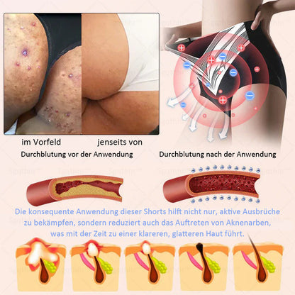 𝐒𝐠𝐪𝐭𝐡𝐡𝐫™ 👩‍⚕️ Sculpting-Hose aus Tourmalin-Titan - ⚡ Perfekte Silhouette, Frauen-Gesundheitspflege   🔥 Letzter Tag 🔥 70 % Rabatt