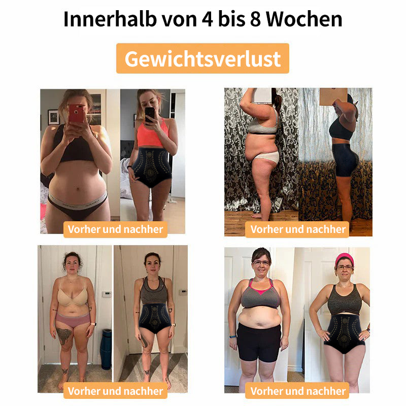 【Offizielle Markenboutique】𝐒𝐠𝐪𝐭𝐡𝐡𝐫™🇩🇪 Ionische Sculpting Shorts & Detox-Fettverbrenner 🩲 Bequeme und atmungsaktive Stoffe, Enthält Turmalin-Gewebe 🔥 Letzter Tag, letzter Tag 🔥 60 % Rabatt