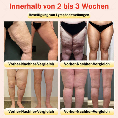 𝐒𝐠𝐪𝐭𝐡𝐡𝐫™ 👩‍⚕️ Sculpting-Hose aus Tourmalin-Titan - ⚡ Perfekte Silhouette, Frauen-Gesundheitspflege   🔥 Letzter Tag 🔥 70 % Rabatt